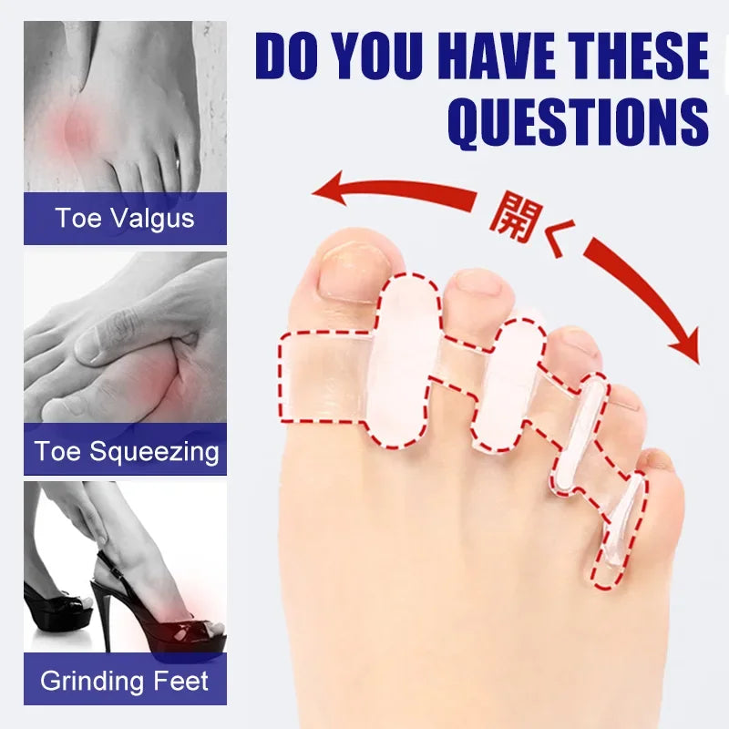 1 Pair Silicone Toe Separator Finger Feet Care Protector Gel Toe Orthopedic Bunion Hallux Valgus Corrector Pedicure Spacer
