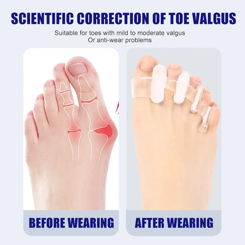 1 Pair Silicone Toe Separator Finger Feet Care Protector Gel Toe Orthopedic Bunion Hallux Valgus Corrector Pedicure Spacer